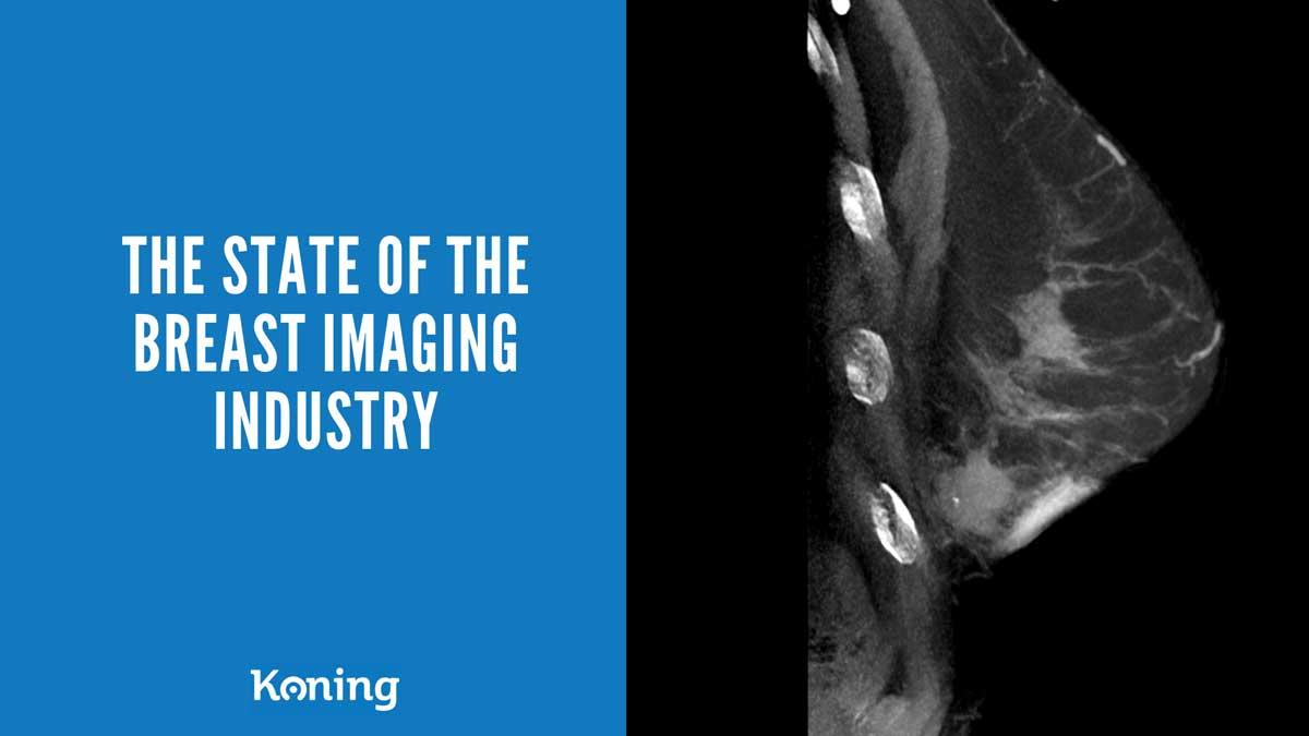 estado de la industria de imagenología mamaria